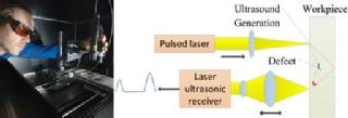 Ultrasound