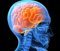 neurology.jpg