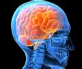 neurology.jpg