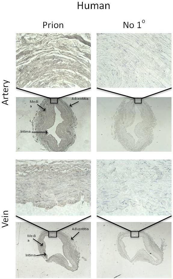 Figure 2: Immunohistochemical detection of PrPC in human internal mammary artery and saphenous vein, using an anti-PrPC antibody.
