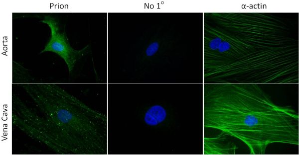 Figure 3: Immunofluorescent labeling of PrPC in cultured smooth muscle cells from aorta and vena cava.