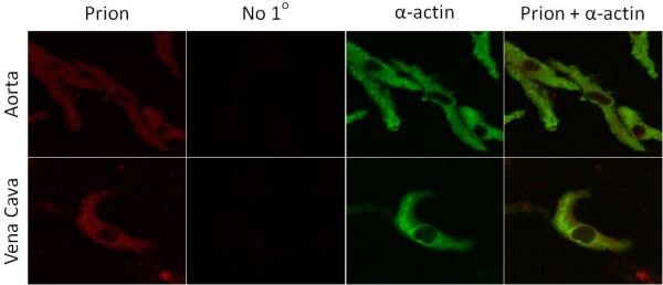 Figure 4: Immunofluorescent labeling of PrPC viewed using confocal microscopy in freshly isolated cells from rat aorta and vena cava.