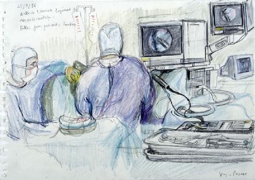 A surgical operation to reconstruct a patient’s anterior cruciate ligament. Drawing by Virginia Powell, 1996. Wellcome Images