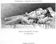Clinical studies on hystero-epilepsy or great hysteria / by Paul Richer;  preceded by a letter-preface by J.-M. Charcot.