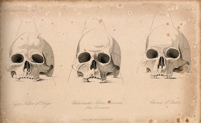 Skulls