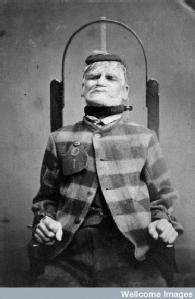 Man in restraint chair, West Riding Lunatic Asylum (1869)