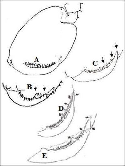 Figure 3. Platorchestia sp. male gnathopod 2