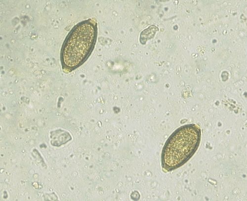 Figure 5: Micrograph displaying the eggs of Capillaria spp