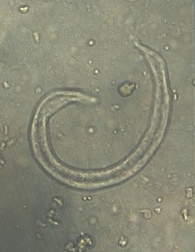 Figure 7: Micrograph displaying the larvae of C. striatum