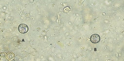 Figure 8: Micrograph displaying protozoan oocysts