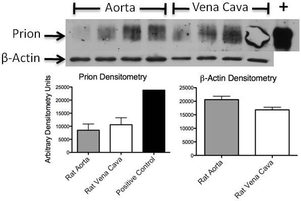 Figure 5: Western Blot analysis of vena cava and aorta samples from rats using an anti-PrPC antibody confirms the presence of PrPC in the blood vessels.