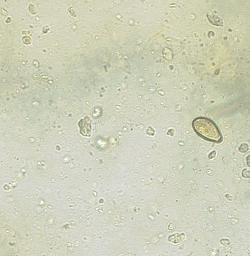 Figure 6: Micrograph displaying an egg of B. erinacei