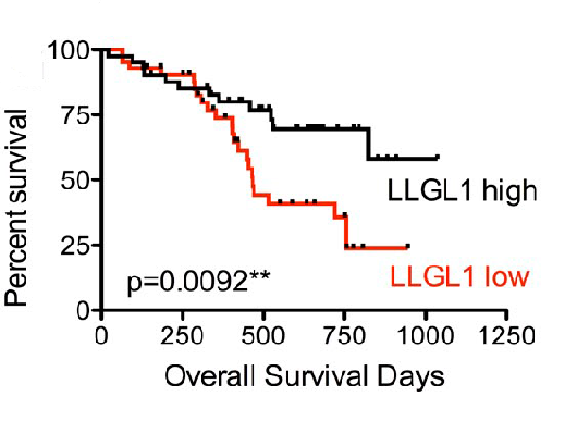 Figure 1: Llgl1 repression leads to the development of human AML. Low expression of Llgl1 was associated with a greater decrease in the overall survival when compared to the high expression Llgl1 cohort in 83 of AML patients below the age of 60 years.