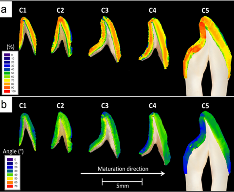 Human enamel mineralisation