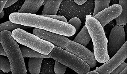 microscopy image of escherichia coli cells