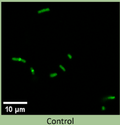 confocal microscopy image of e. coli k12 ftsz-mneon cells with no treatment