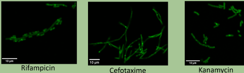 confocal microscopy image of e. coli k12 ftsz-mneon cells treated with rifampicin, cefotaxime and kanamycin