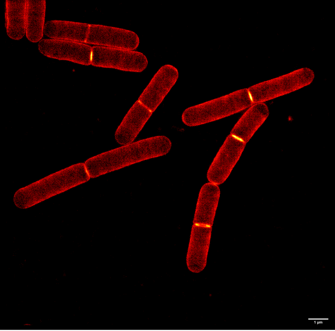 STORM image of bacteria