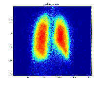 Lung scan image