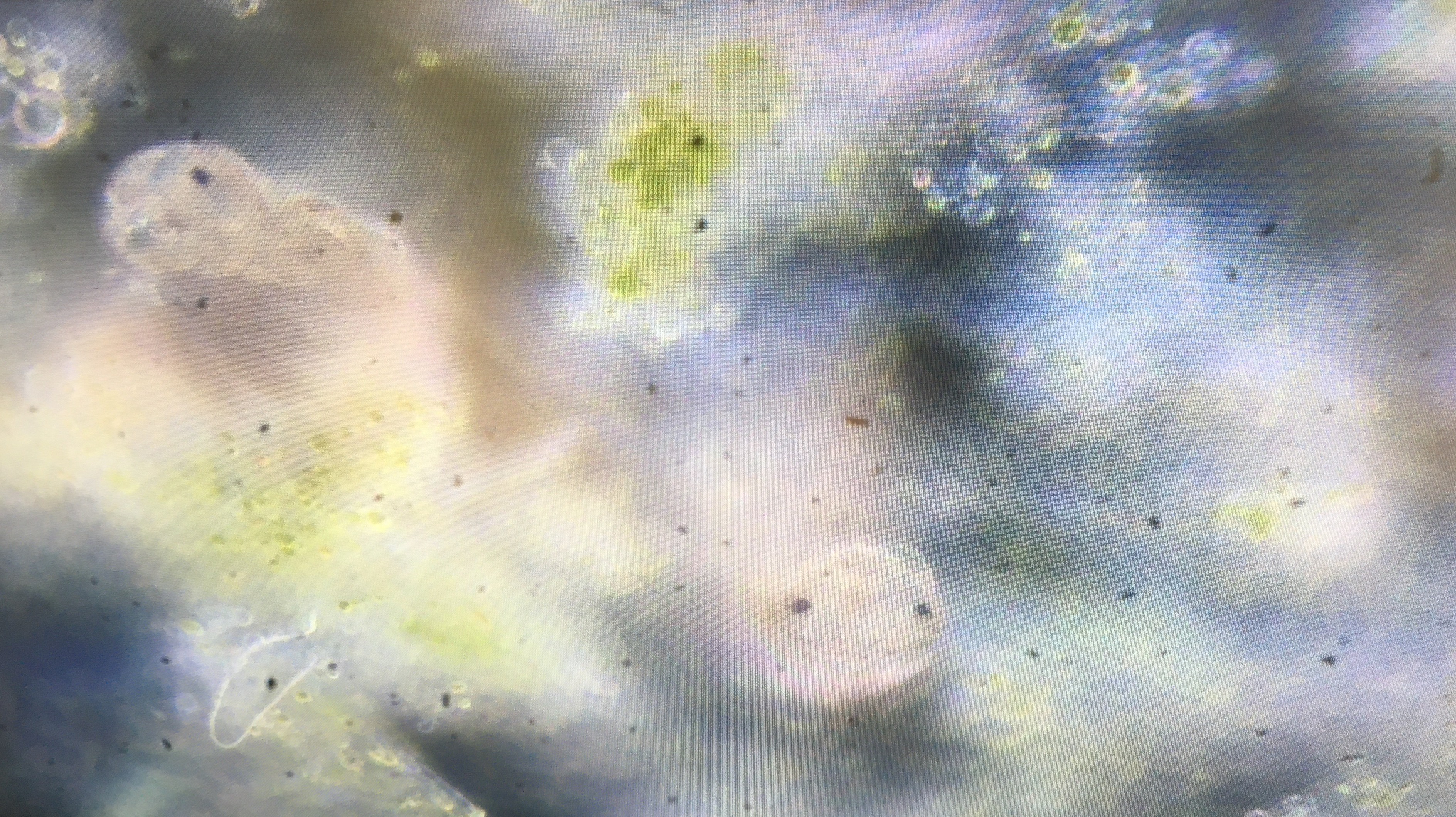 An image of two tardigrades from Brandon Marsh pond