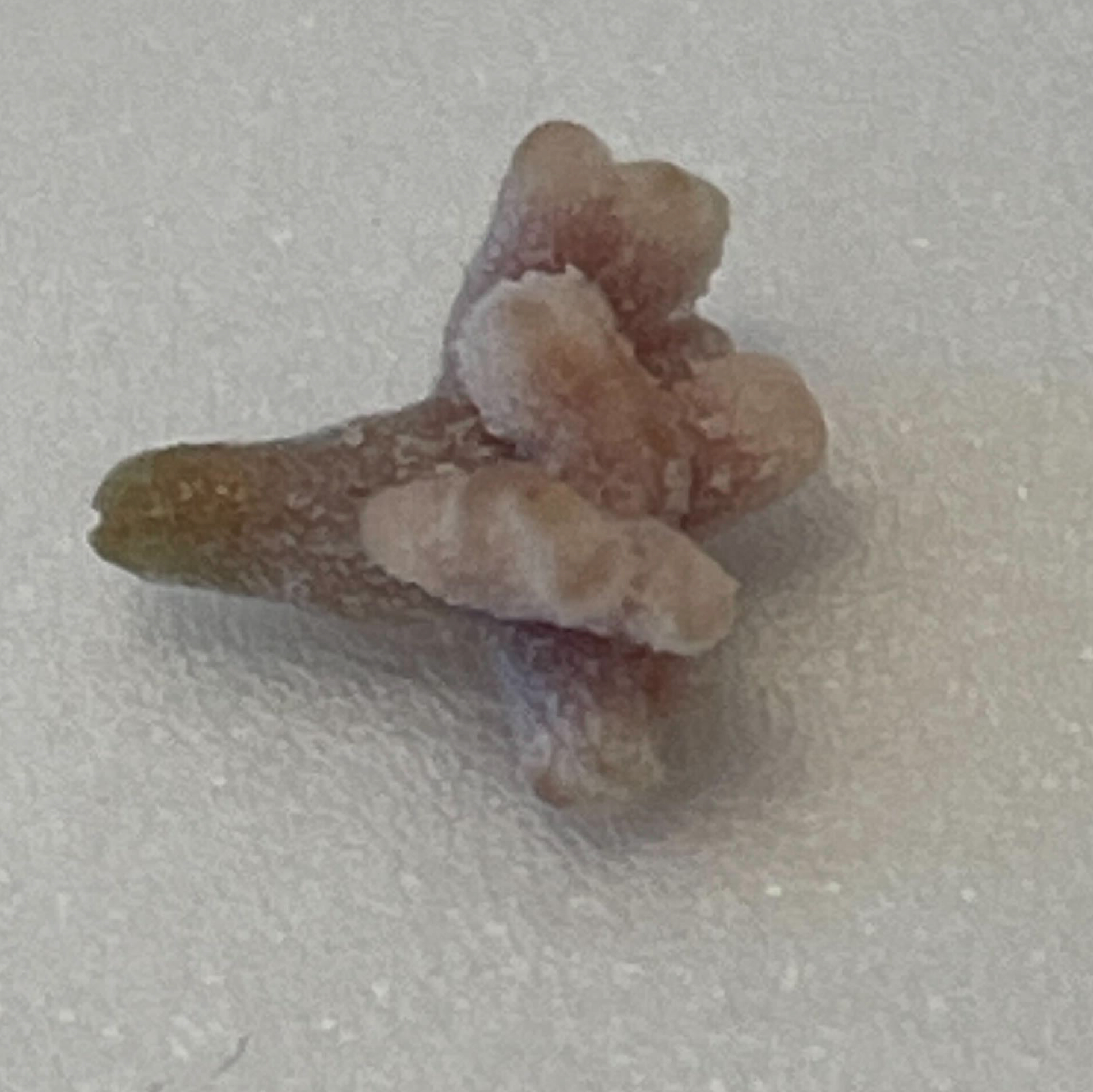 A nodule extracted from a root of a Medicago truncatula plant that had been inoculated with the rhizobium Ensifer meliloti WSM1022. As many as nine lobes are apparent in the nodule, each with its own meristem.