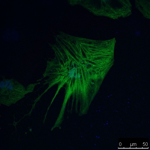 Human astrocyte expressing HIV-1 Gag-GFP