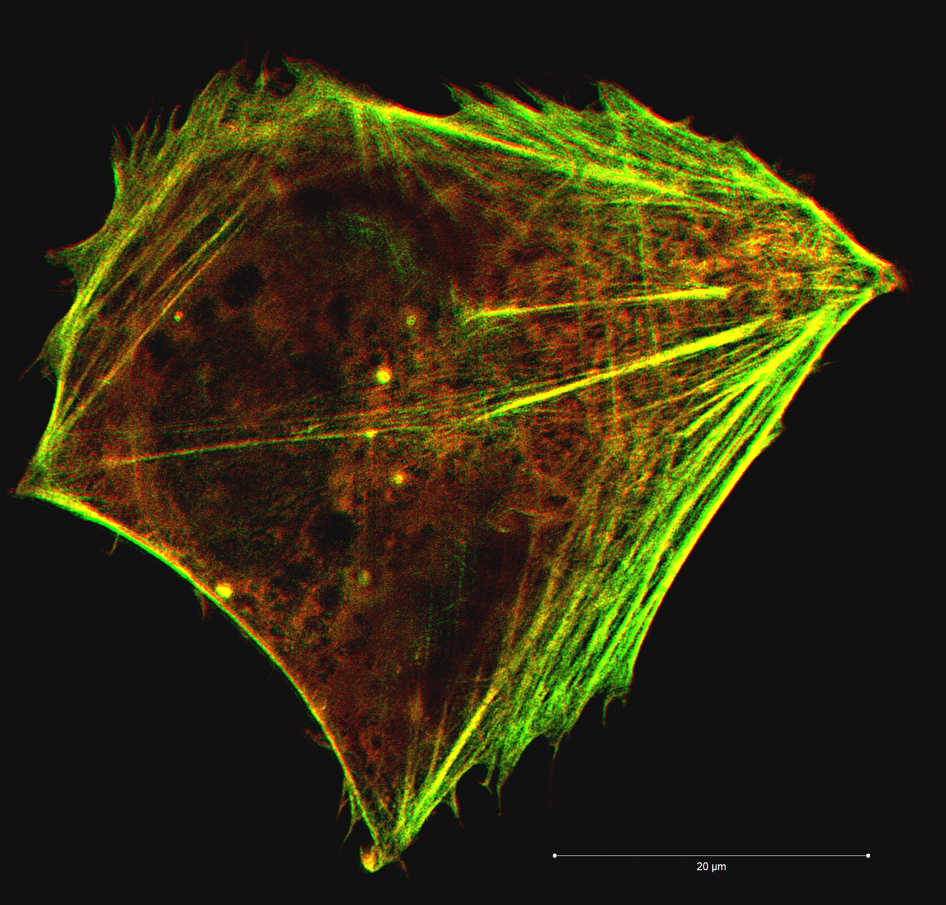 Thin filaments of the cells cytoskeleton
