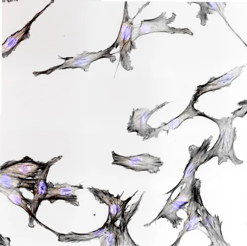 image 1 crawling around