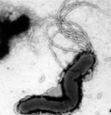 Helicobacter pylori with unipolar multiple flagella