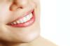 Restorative Dentistry - woman smiling
