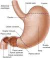 Stomach and its different sections. The fundus is on the curved top part of the stomach.