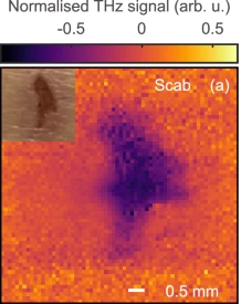 THz image of scab tissue