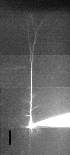 A layer 5 pyramidal neuron with patch electrodes at the soma (right, with fluorescent dye) and on the apical dendrite (left, faint electrode).  Using this challenging technique we can probe the effects of adenosine at the normally inaccessible apical dendrite, which acts as an important input integrator.