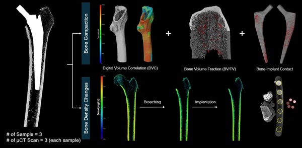  Insights into how bone microstructure changes during surgery