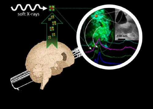 Nanoscale synchrotron X-ray reveals iron and calcium compounds in amyloid plaque cores from Alzheimer
