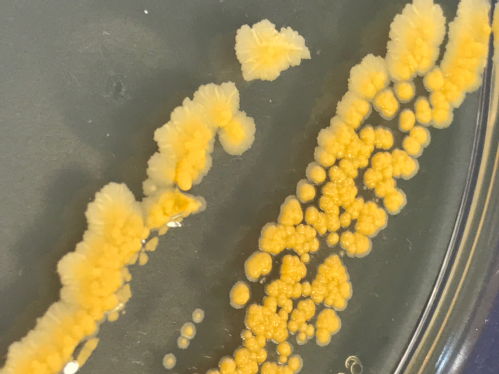 bacteria