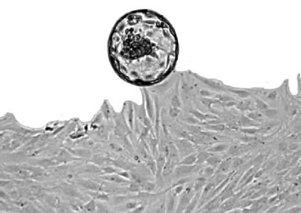 a histological slide, demonstrating uNK cells in the womb lining (brown staining).