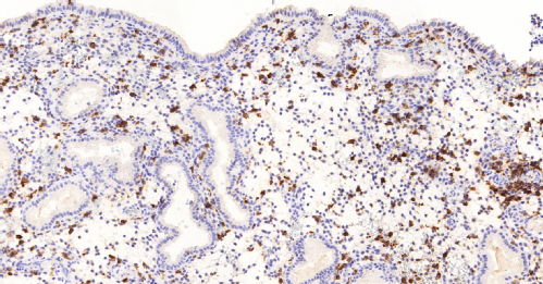 image from a human embryo cultured with decidual cells in the lab 