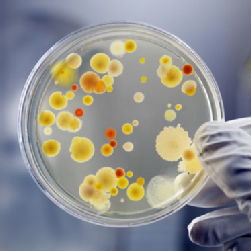 Microbes on an agar plate