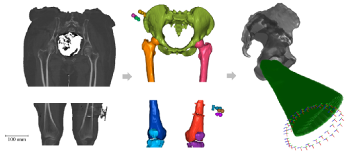 Digital scans of hip joints