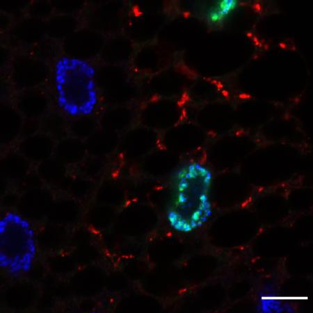 Cells expressing GFP-Sequoia-LIR mutant (green nuclei) activate autophagy (shown by red puncta)