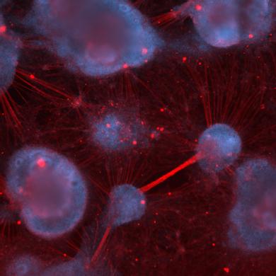 Image shows human sensory neurons derived from stem cells cultured in the lab. Image by Alexandra Sarginson