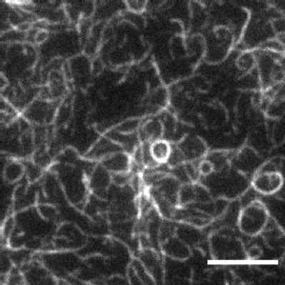 Microscopy image of fluorescently labelled actin filaments bound to lipid bilayer bound Rng2(1-189)-His6 (scale bars: 5 µm)