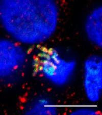 Autophagy attacks Salmonella. Autophagosomes (red) colocalizes with Salmonella (green) in HT-29 intestinal epithelial cells. Image taken by Dr Anne-Claire Jacomin. Credit: Dr Anne-Claire Jacomin/ University of Warwick