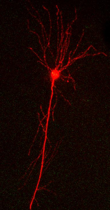 A confocal image of a neuron which has had tau oligomers introduced to it