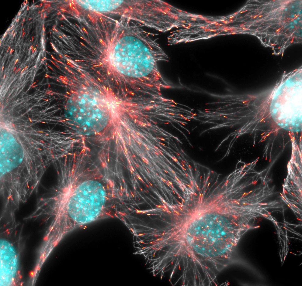 An image of cell skeleton reassembly by Anne Straube 