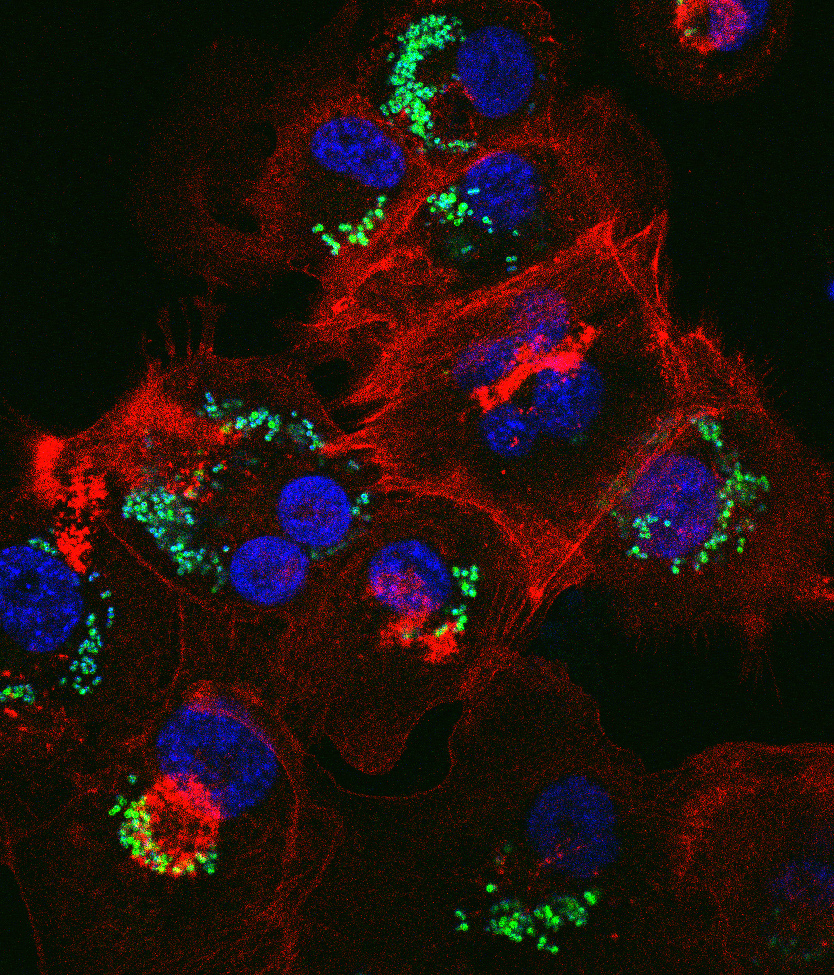 An image of MRSA inside human macrophages by Meera Unnikrishnan and Kate Watkins  