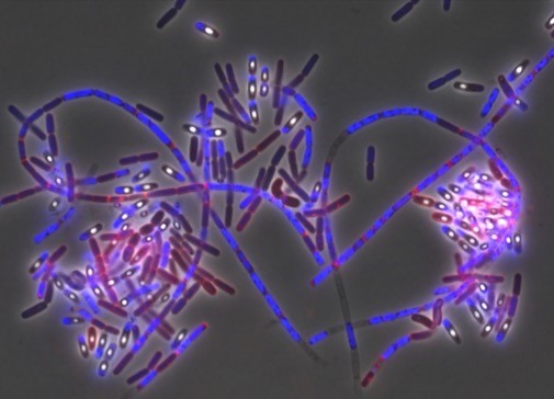 An image of an anthrax-like bacterial strain by Nick R. Waterfield and Thomas Brooker