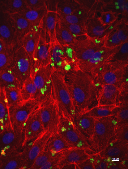 An image of epithelial cells infected with MRSA by Pooja Agarwal 