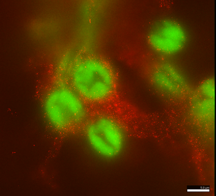 An image of virus-infected kidney cells by Reanna Gregory